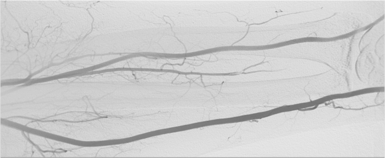 Fig. 3
