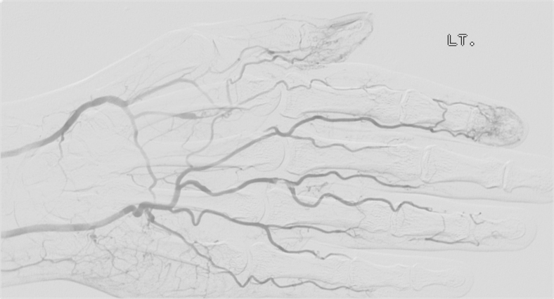 Fig. 4