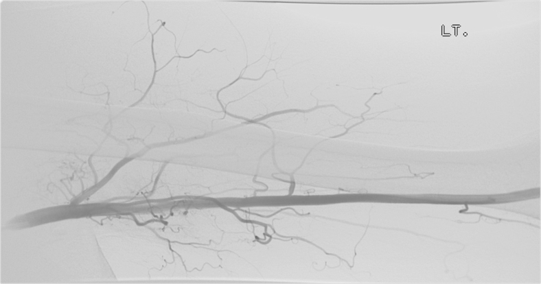 Fig. 2