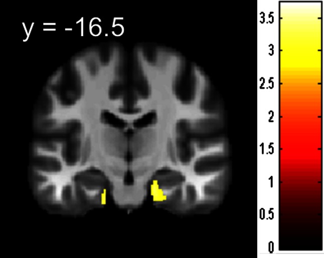 Fig. 3