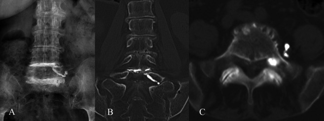 Figure Nº4