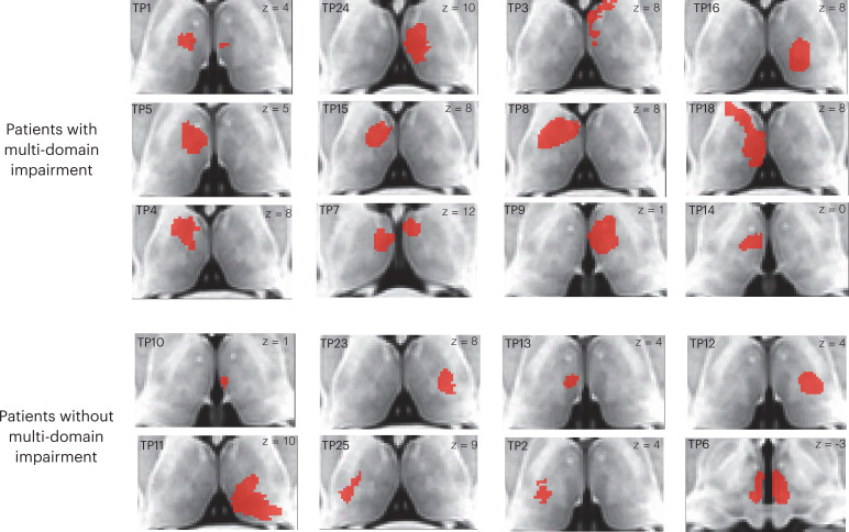 Figure 2—figure supplement 1.