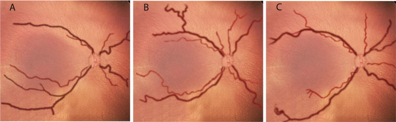 FIG 2