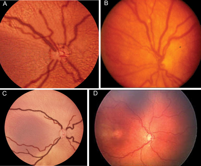 FIG 3