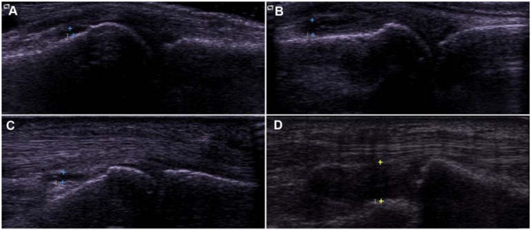 Fig. (2)