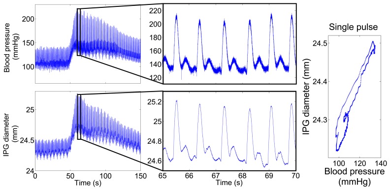 Figure 11.