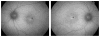 Fig 5