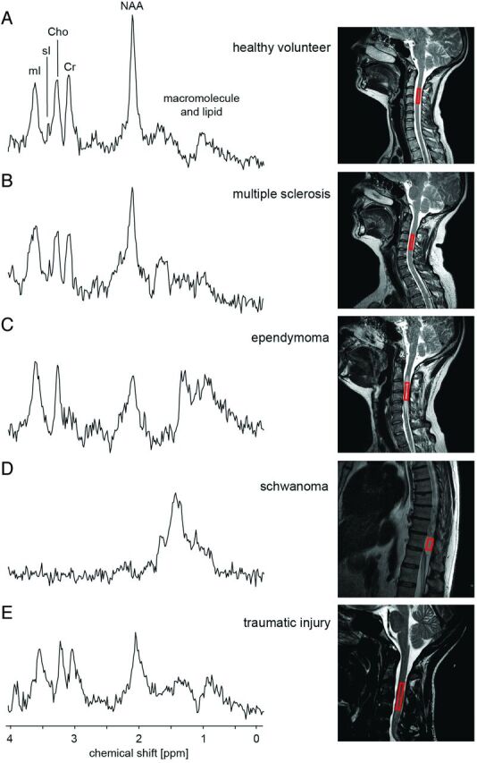 Fig 3.