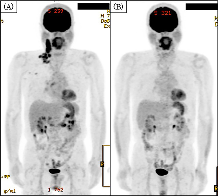 FIGURE 2