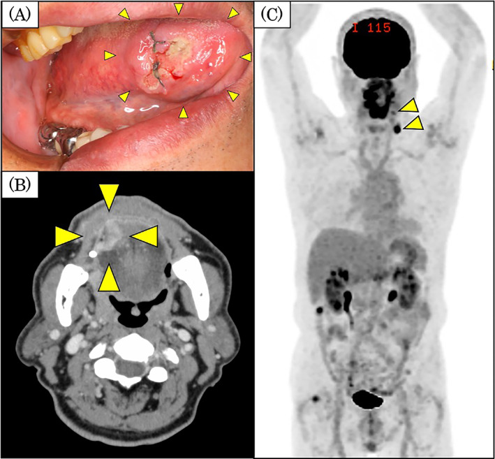 FIGURE 3