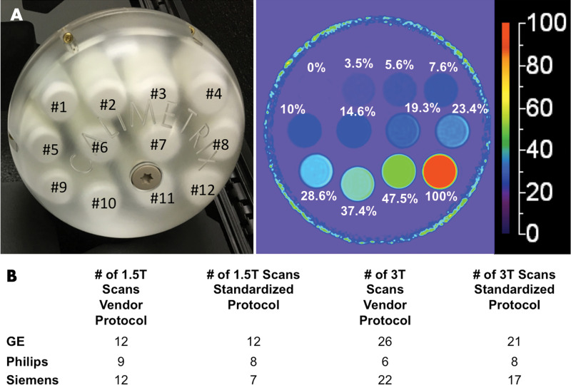 A, Photograph of phantom, which consisted of spherical acrylic housing containing 12 vials with known proton density fat fraction (PDFF) values, submerged in contrast medium–doped water bath. Representative PDFF parametric map with 0%–100% color scale. Phantom-derived reference PDFF values are shown based on volumes of ingredients used. B, Total number of examinations performed, categorized according to protocol, magnetic field strength, and vendor.