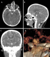 Fig. 4