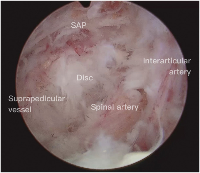 Figure 14.