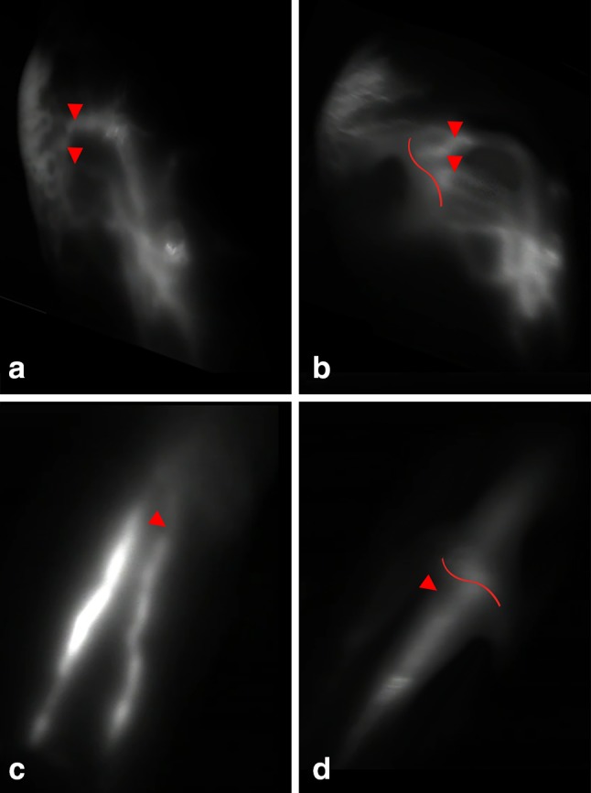 Fig. 1