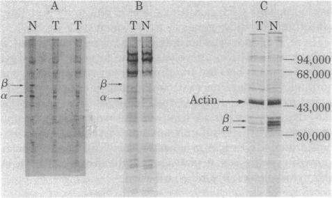 graphic file with name pnas00660-0397-a.jpg