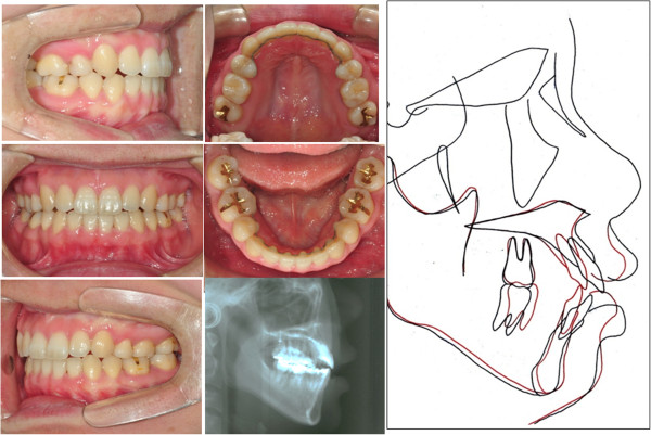 Figure 10