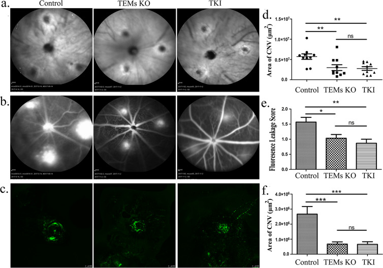 Essential Contribution Of Macrophage Tie Signalling In A Murine Model Of Laser Induced