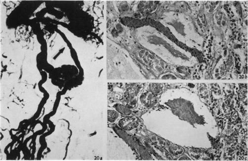 Fig. 20