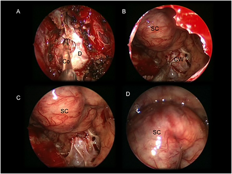 Fig 1