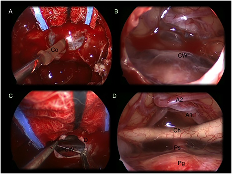 Fig 3