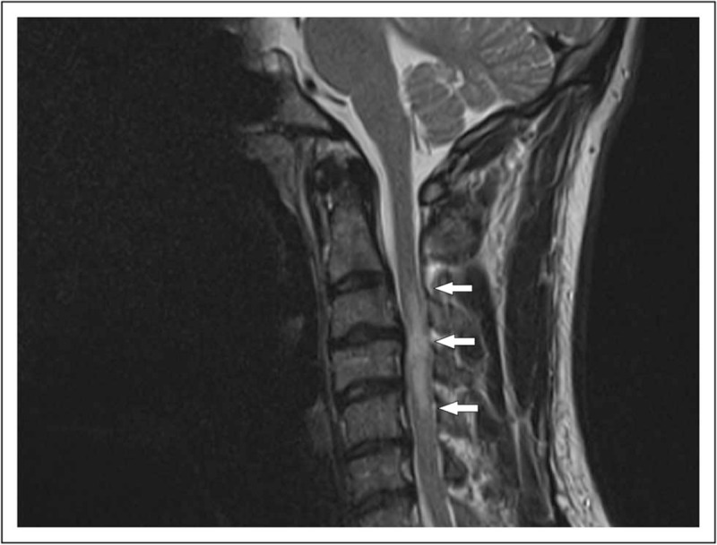 FIGURE 2