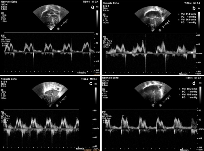 Fig. 4