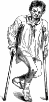 Fig. 14