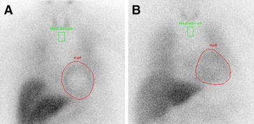 Figure 11