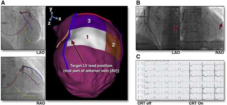 Figure 13