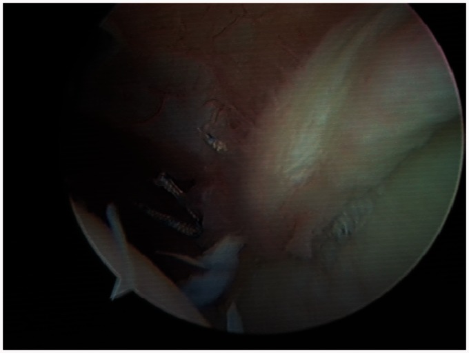 Figure 6.