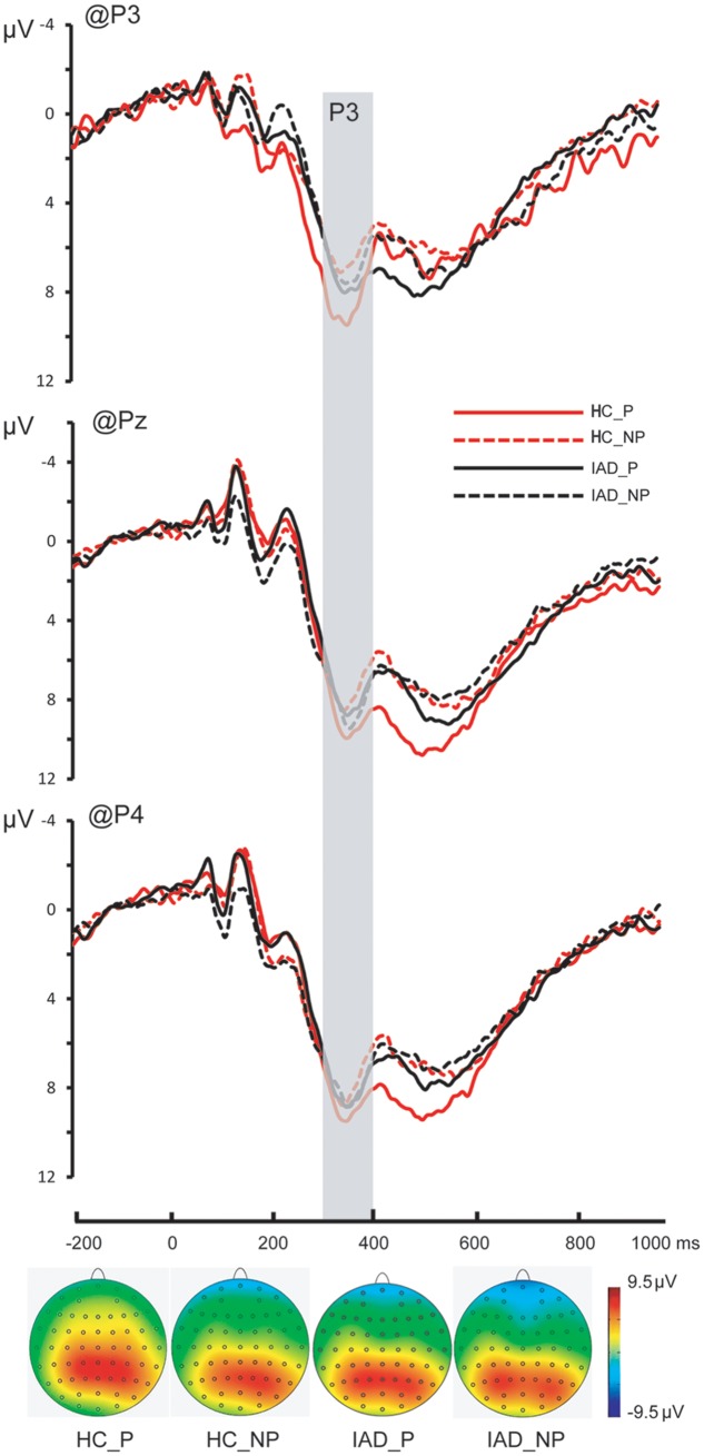 FIGURE 3