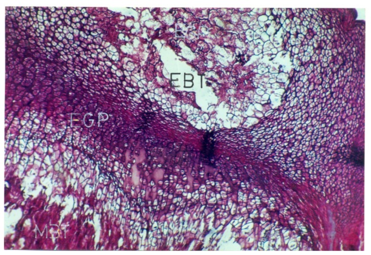 Figure- 4