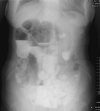 Fig. 5