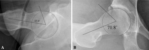 Fig. 2A–B