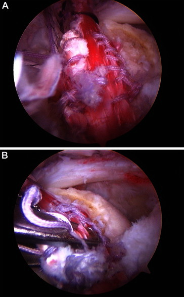 Fig 4