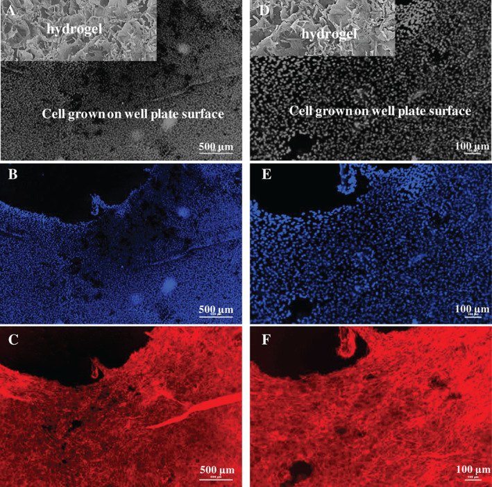 IWJ-12762-FIG-0010-c