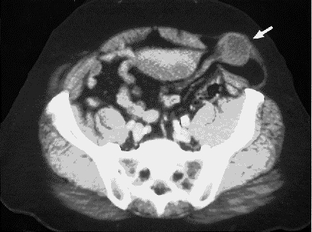 graphic file with name 10FF2.jpg