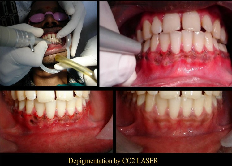 Figure 3