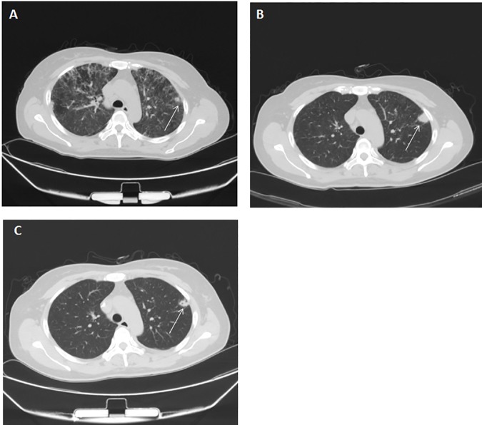 Fig 3