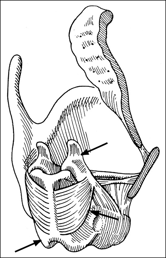 fig 2.