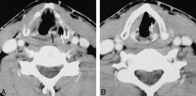 fig 3.