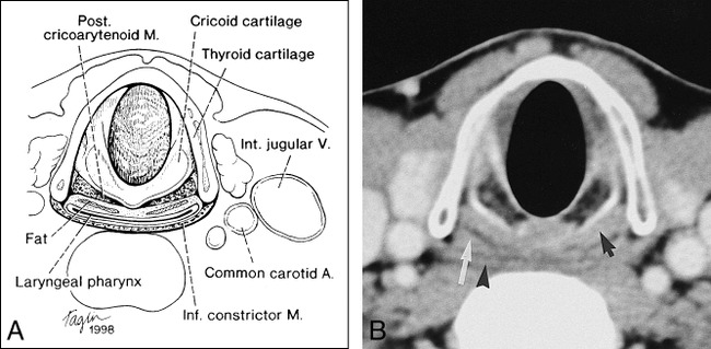 fig 1.