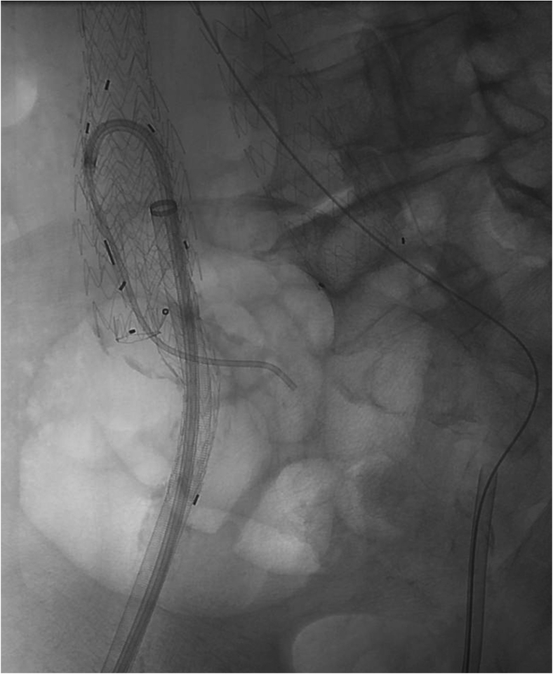 Fig 2