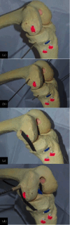 Figure 15