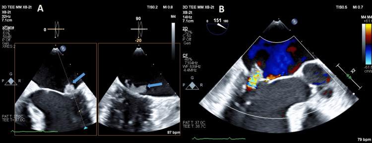 Figure 5