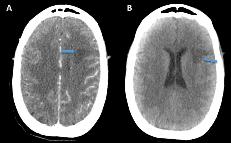Figure 7
