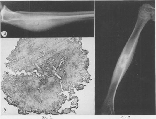 Fig. 1., Fig. 2.