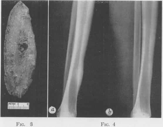 Fig. 3., Fig. 4.