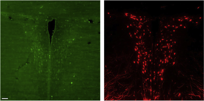 Figure 15