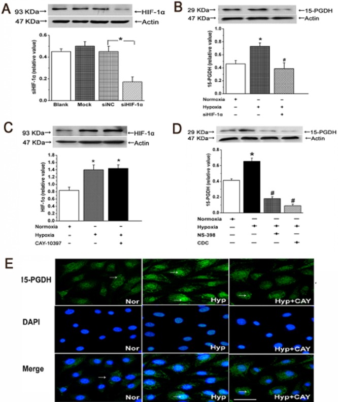 Hypoxia activates 15-PGDH and its metabolite 15-KETE to promote ...